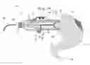 Fig. 01 - Tissue-characterization probe with effective sensor-to-tissue contact