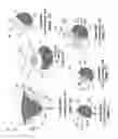 Fig. 04 - Tissue-characterization probe with effective sensor-to-tissue contact