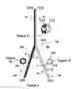 Fig. 04 - Multilumen catheter with pressure resistant lumen and method