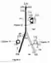 Fig. 05 - Multilumen catheter with pressure resistant lumen and method