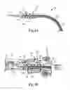 Fig. 06 - Renal Nerve Ablation Using Mild Freezing and Vibration