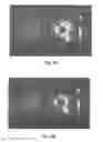 Fig. 08 - Systems and methods for making and using rotational transducers for concurrently imaging blood flow and tissue