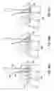 Fig. 29 - Flexible neural localization devices and methods