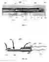 Fig. 02 - Surgical tool