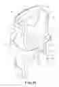 Fig. 08 - Hyperextension knee brace