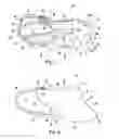 Fig. 02 - Orthotic device and method of manufacture