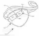 Fig. 01 - Apparatus, composition, and method to treat amblyopia