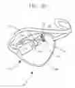 Fig. 07 - Apparatus, composition, and method to treat amblyopia