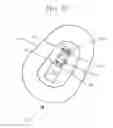 Fig. 08 - Apparatus, composition, and method to treat amblyopia