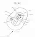 Fig. 09 - Apparatus, composition, and method to treat amblyopia