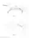Fig. 09 - INTRAOCULAR SHUNTS