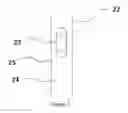 Fig. 05 - METHODS FOR IMPLANATION OF GLAUCOMA SHUNTS