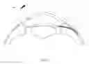 Fig. 08 - METHODS FOR IMPLANATION OF GLAUCOMA SHUNTS