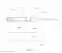Fig. 16 - METHODS FOR IMPLANATION OF GLAUCOMA SHUNTS