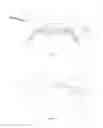 Fig. 20 - METHODS FOR IMPLANATION OF GLAUCOMA SHUNTS