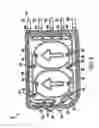 Fig. 11 - Medical treatment system and methods using a plurality of fluid lines