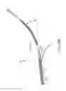 Fig. 22 - CATHETER SYSTEMS WITH DISTAL END FUNCTION, SUCH AS DISTAL DEFLECTION, USING REMOTE ACTUATION OR LOW INPUT FORCE