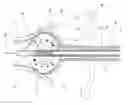 Fig. 01 - BALLOON CATHETER SYSTEM