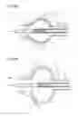 Fig. 06 - BALLOON CATHETER SYSTEM