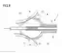 Fig. 10 - BALLOON CATHETER SYSTEM