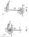 Fig. 02 - NEEDLE-BASED MEDICAL DEVICE AND RELATED METHOD