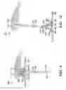 Fig. 07 - NEEDLE-BASED MEDICAL DEVICE AND RELATED METHOD