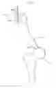 Fig. 05 - Implantable circulating lubrication system for joints