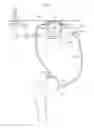 Fig. 06 - Implantable circulating lubrication system for joints