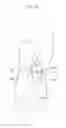 Fig. 19 - Implantable circulating lubrication system for joints