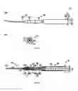 Fig. 02 - Internal needle