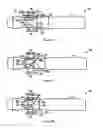 Fig. 20 - Internal needle