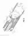 Fig. 03 - Flexible debulking catheters with imaging and methods of use and manufacture