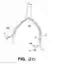 Fig. 27 - Flexible debulking catheters with imaging and methods of use and manufacture
