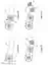 Fig. 03 - ERODIBLE EMBOLIZATION MATERIAL