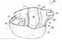 Fig. 01 - REPLACEABLE ABSORBENT INSERT FOR USE IN TWO-PIECE DIAPERING SYSTEM WITH RE-USABLE DIAPER SHELL