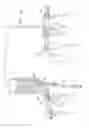 Fig. 10 - Safety drug handling device