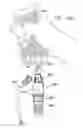 Fig. 74 - Safety drug handling device