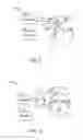 Fig. 04 - Vestibular stimulator