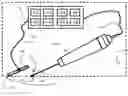 Fig. 01 - METHOD AND APPARATUS FOR LIPOSUCTION