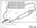 Fig. 02 - METHOD AND APPARATUS FOR LIPOSUCTION