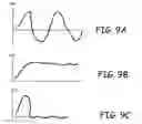 Fig. 14 - METHOD AND APPARATUS FOR LIPOSUCTION