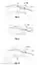 Fig. 06 - Fingertip Electrosurgical Instruments for Use in Hand-Assisted Surgery and Systems Including Same
