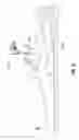 Fig. 08 - Fingertip Electrosurgical Instruments for Use in Hand-Assisted Surgery and Systems Including Same