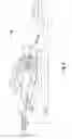Fig. 03 - Power glove