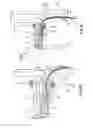 Fig. 08 - Self-expanding cooling electrode for renal nerve ablation
