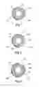 Fig. 09 - Self-expanding cooling electrode for renal nerve ablation