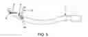 Fig. 06 - Method and apparatus for passing suture through tissue