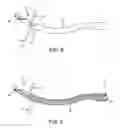 Fig. 09 - Method and apparatus for passing suture through tissue