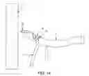 Fig. 14 - Method and apparatus for passing suture through tissue