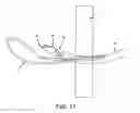 Fig. 17 - Method and apparatus for passing suture through tissue